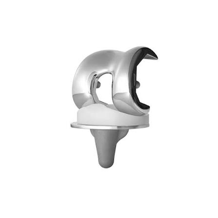 Knee Implants
